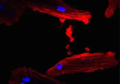 Mouse heart cells that have taken up adipocyte-derived extracellular vesicles (stained red) Mouse heart cells that have taken up adipocyte-derived extracellular vesicles (stained red)